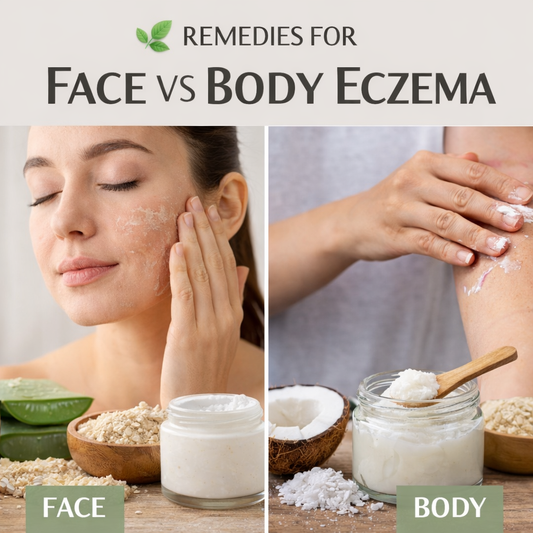 REMEDIES FOR FACE VS BODY ECZEMA